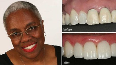 Before and After Photo